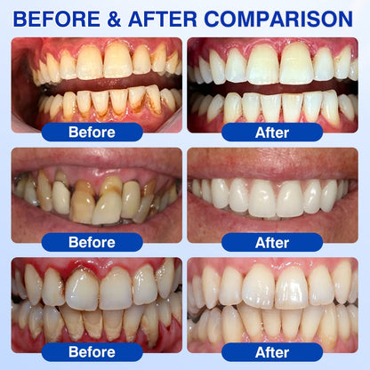 🇺🇸🏆🦷🛡️Evolvion® GumRevive Periodontal Repair Gel💫💫💫💫💫💫