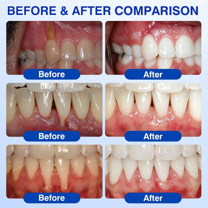 🇺🇸🏆🦷🛡️Evolvion® GumRevive Periodontal Repair Gel💫💫💫💫💫💫