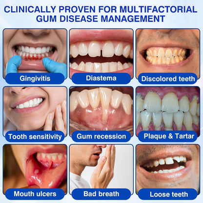 🇺🇸🏆🦷🛡️Evolvion® GumRevive Periodontal Repair Gel💫💫💫💫💫💫