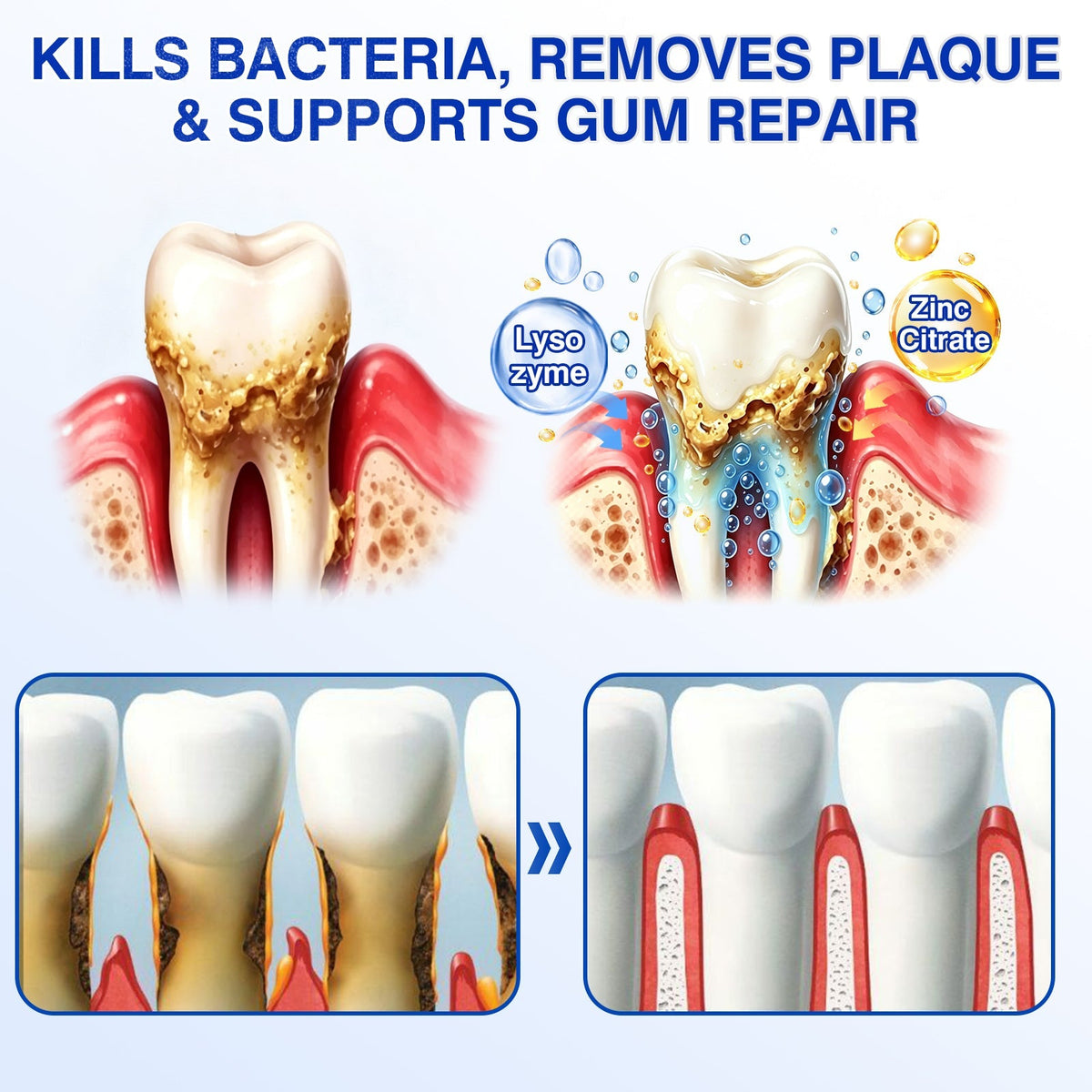 🇺🇸🏆🦷🛡️Evolvion® GumRevive Periodontal Repair Gel💫💫💫💫💫💫
