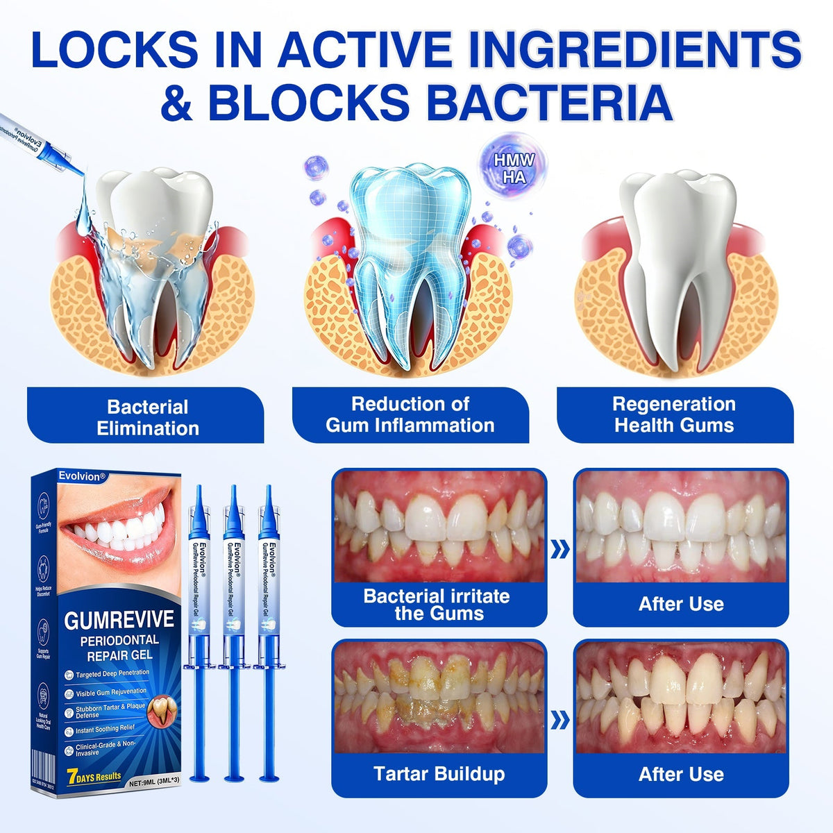 🇺🇸🏆🦷🛡️Evolvion® GumRevive Periodontal Repair Gel💫💫💫💫💫💫