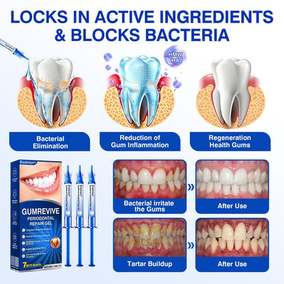 🇺🇸🏆🦷🛡️Evolvion® GumRevive Periodontal Repair Gel💫💫💫💫💫💫